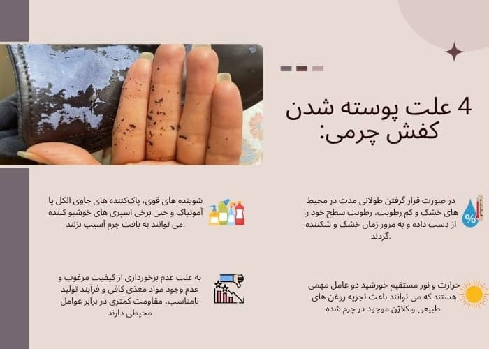 علت پوسته شدن کفش چرمی